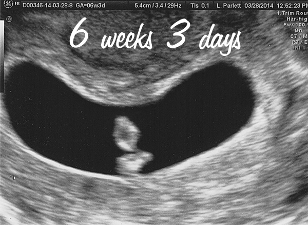 6 Weeks Pregnant Symptoms Ultrasound Cramping What To Expect