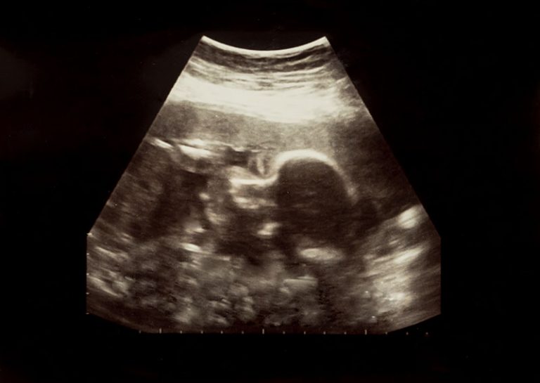 27 Week Ultrasound | Pregnancy Health